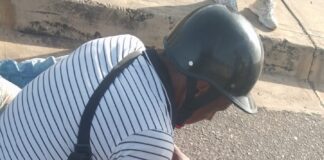 Motorizado resulta herido en la Intercomunal Alí Primera de Punto Fijo
