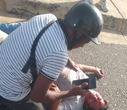 Motorizado resulta herido en la Intercomunal Alí Primera de Punto Fijo