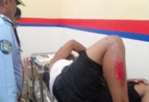 Dos jovenes resultan heridos tras aparatoso deslizamiento en moto en la Coro-Churuguara