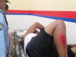 Dos jovenes resultan heridos tras aparatoso deslizamiento en moto en la Coro-Churuguara