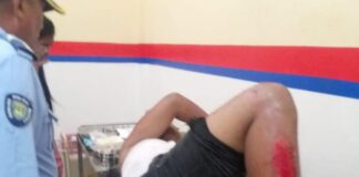 Dos jovenes resultan heridos tras aparatoso deslizamiento en moto en la Coro-Churuguara