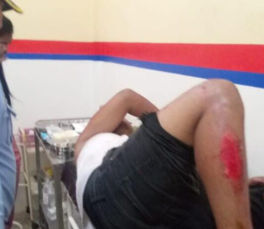 Dos jovenes resultan heridos tras aparatoso deslizamiento en moto en la Coro-Churuguara
