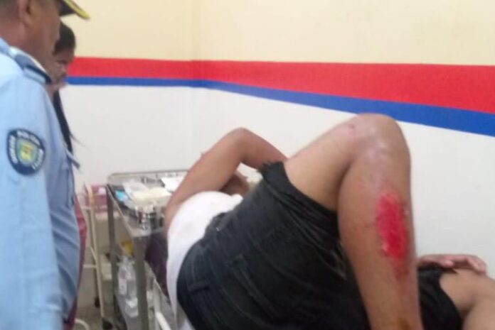 Accidente Churuguara 1