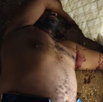 Asesinan a un hombre a balazos en La Vela de Coro: sicarios huyeron a pie por zona boscosa