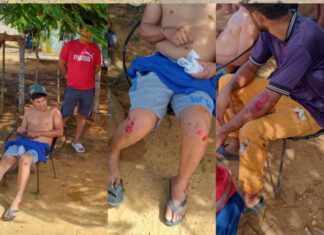 Explosión de neumático ocasiona deslizamiento de moto y deja dos lesionados en la Morón -Coro