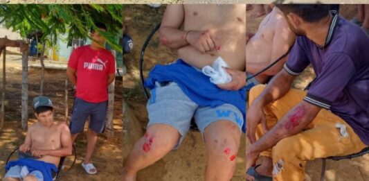 Explosión de neumático ocasiona deslizamiento de moto y deja dos lesionados en la Morón -Coro