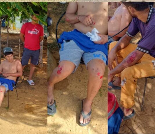Explosión de neumático ocasiona deslizamiento de moto y deja dos lesionados en la Morón -Coro