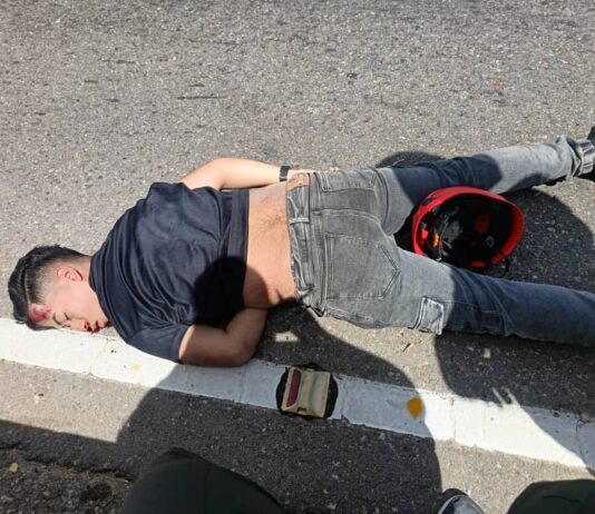 Motorizado se debate entre la vida y la muerte tras brutal choque por alcance en Punto Fijo