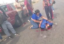 Mototaxista resulta lesionado tras impacto vehicular en la avenida Chema Saher de Coro