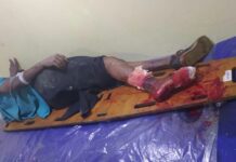 Hombre de 50 años sufre graves fracturas tras deslizar en su moto en San Pedro de Adicora