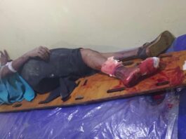 Hombre de 50 años sufre graves fracturas tras deslizar en su moto en San Pedro de Adicora