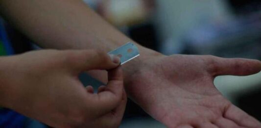 Joven se cortó las venas tras una discusión con su pareja en el municipio Federación