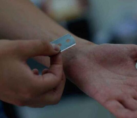 Joven se cortó las venas tras una discusión con su pareja en el municipio Federación