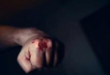 Sujeto resultó herido tras acalorada riña en Antiguo Aeropuerto