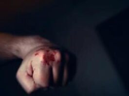 Sujeto resultó herido tras acalorada riña en Antiguo Aeropuerto