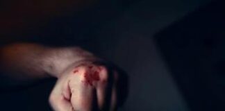 Sujeto resultó herido tras acalorada riña en Antiguo Aeropuerto