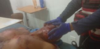 Madrugada trágica en la Morón-Coro: motorizado resultó herido tras deslizamiento en Tucacas