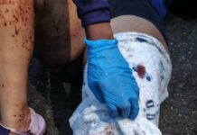 Una mujer y una niña de cinco años lesionadas en accidente de tránsito