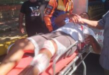 Accidente en la avenida Los Médanos deja un comerciante lesionado