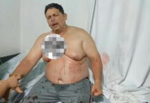 Sujetos desconocidos disparan a productor en el sector El Roble en Buchivacoa