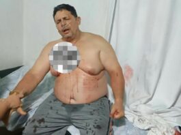 Sujetos desconocidos disparan a productor en el sector El Roble en Buchivacoa