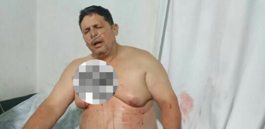 Sujetos desconocidos disparan a productor en el sector El Roble en Buchivacoa