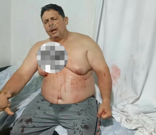 Sujetos desconocidos disparan a productor en el sector El Roble en Buchivacoa
